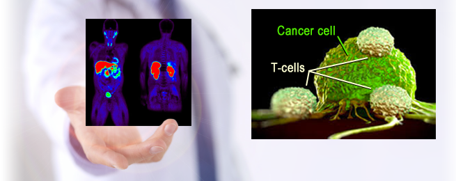 Clinical image of Pre/Post PET scan